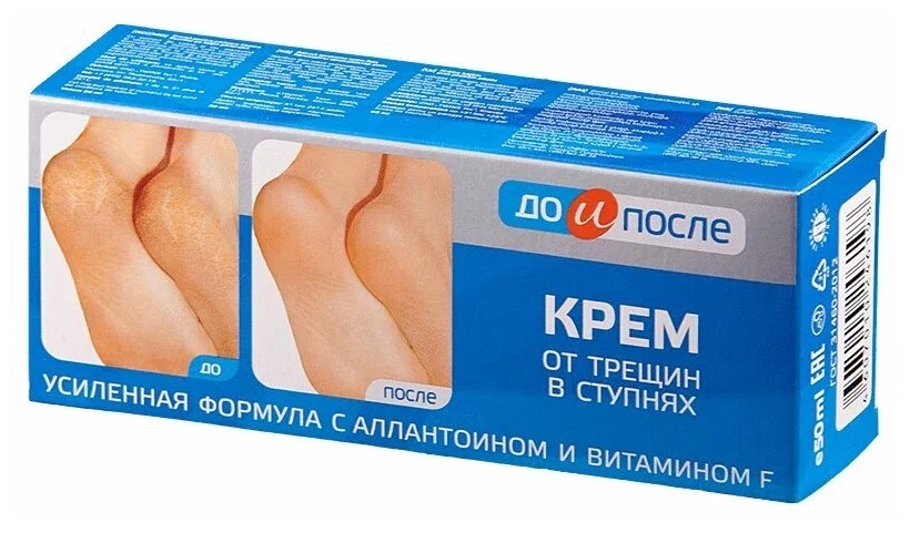 До и после крем д/ног от трещин 150мл